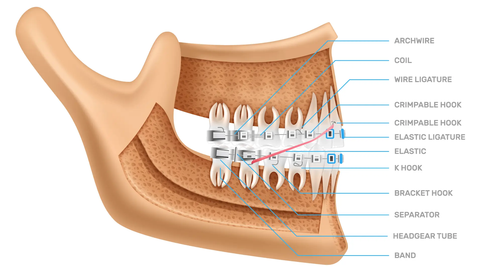 orthodontic treatment